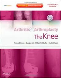 Image of Arthritis & Arthroplasty The Knee