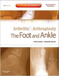 Image of Arthritis & Arthroplasty The Foot and Ankle
